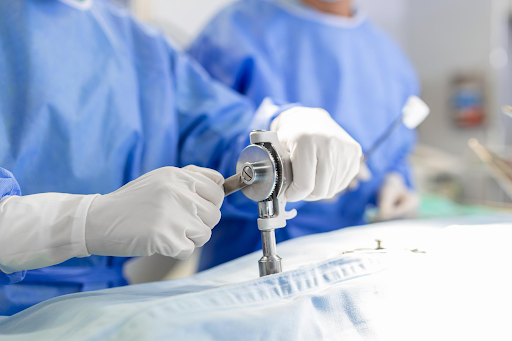 Upper Endoscopy